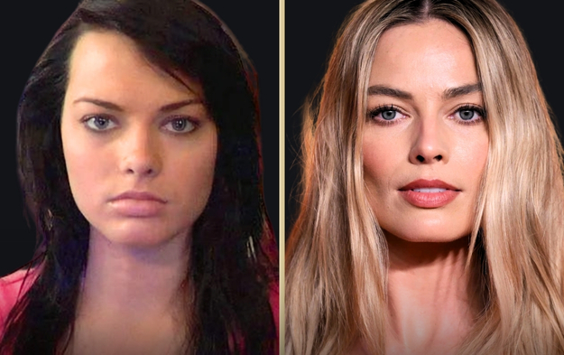 Margot Robbie Plastic Surgery: Separating Fact from Fiction